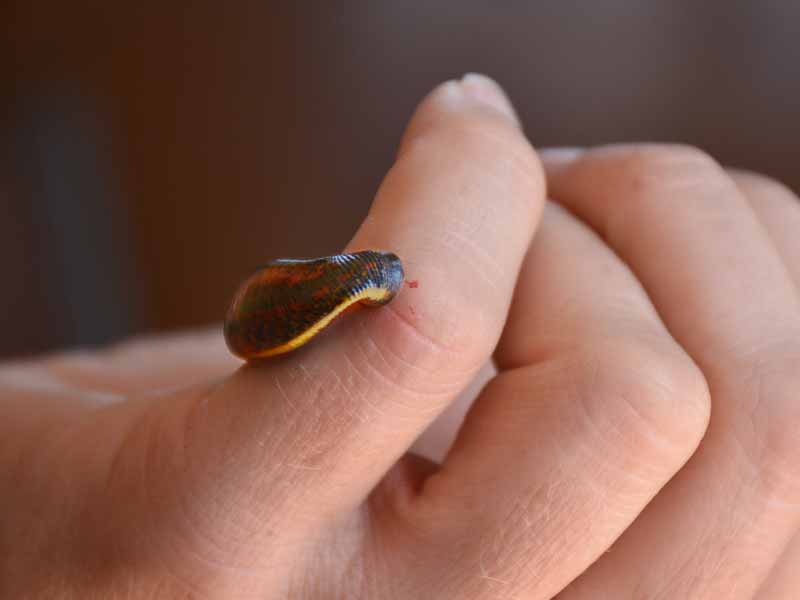 Blutegel an einem Finger während einer Behandlung