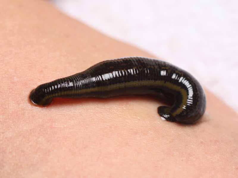 Blutegel saugt auf menschlicher Haut