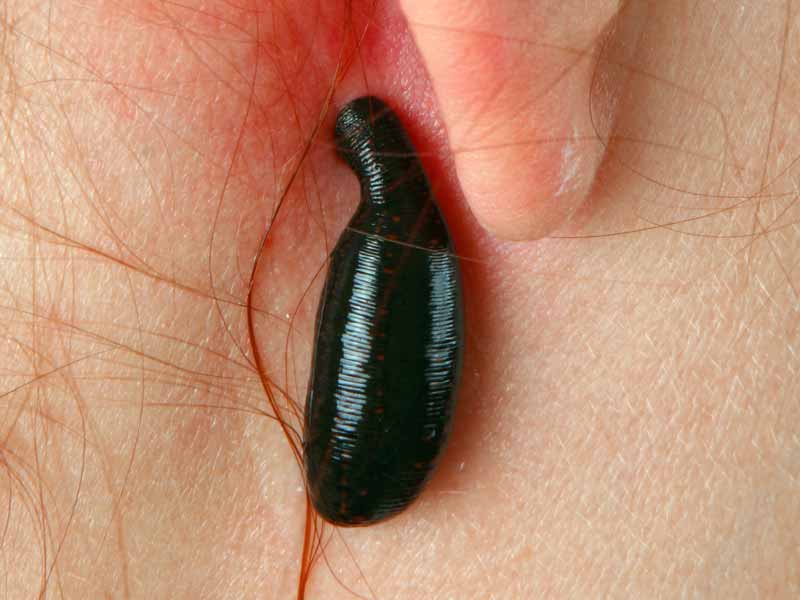 naturheilpraxis bunjes leistung tinnitus blutegel ohr nahaufnahme