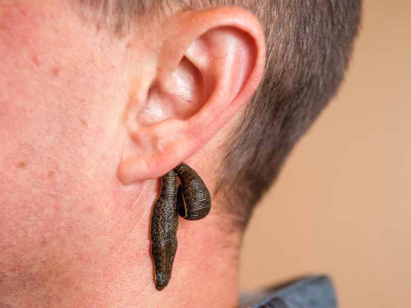 naturheilpraxis bunjes leistung tinnitus blutegel ohr